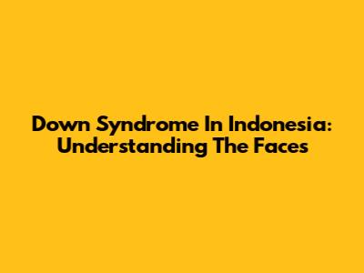 Down Syndrome In Indonesia: Understanding The Faces