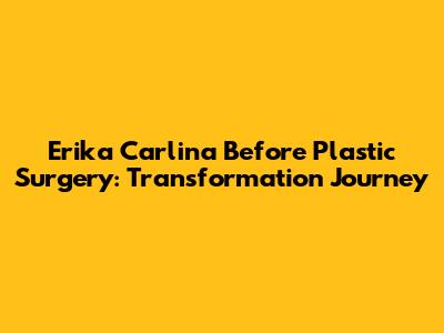 Erika Carlina Before Plastic Surgery: Transformation Journey