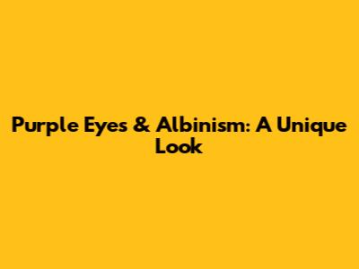 Purple Eyes & Albinism: A Unique Look