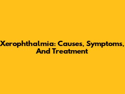Xerophthalmia: Causes, Symptoms, And Treatment